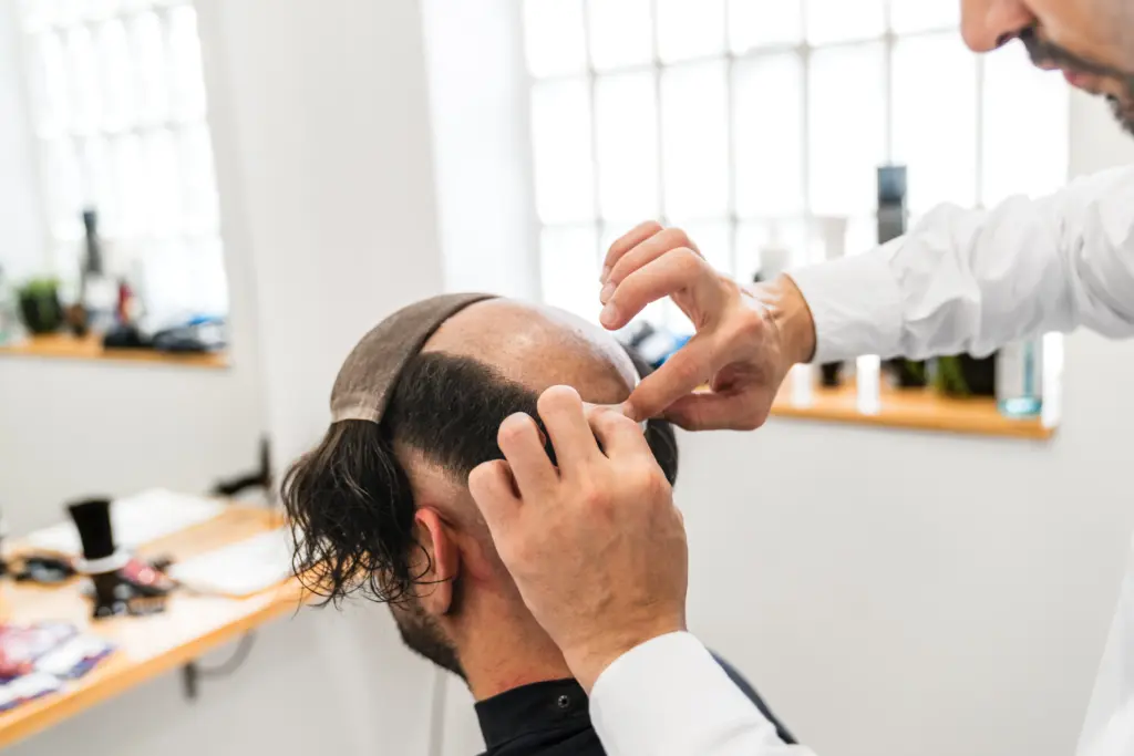 non-surgical-hair-restoration