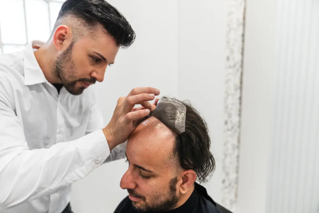 non-surgical-hair-restoration