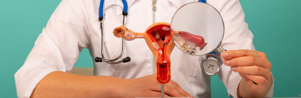 male doctor showing anatomical model female reproductive organs using magnifying glass early diagnosis treatment 3 1 LIV Hospital