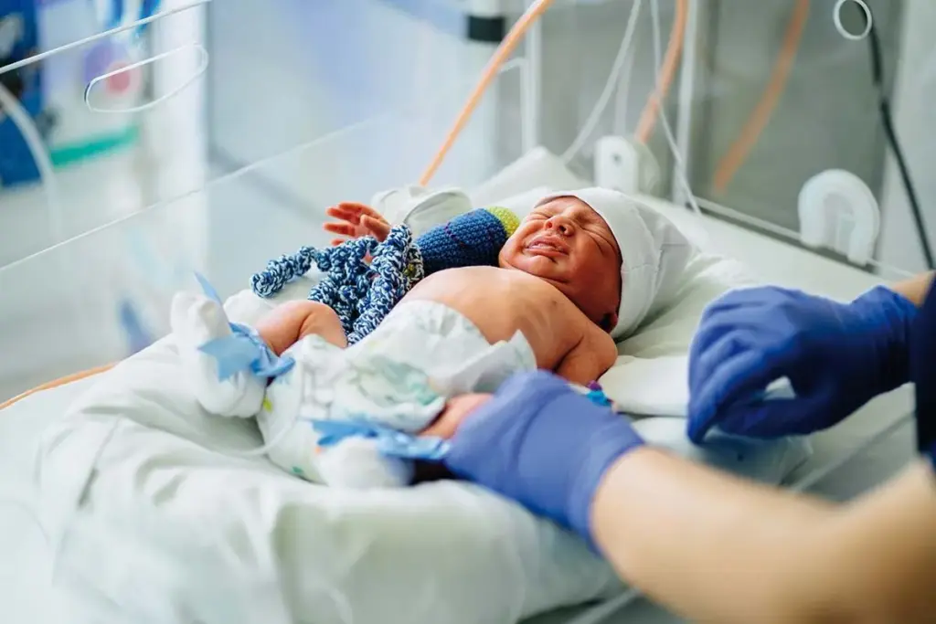 Neonatal Sepsis: Diagnosis and Evaluation