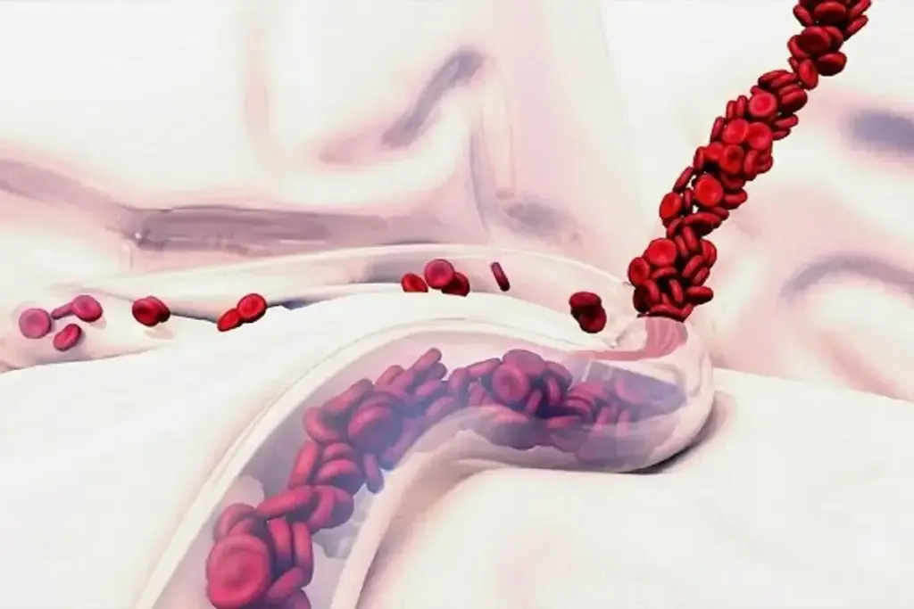 Mucocutaneous Manifestations