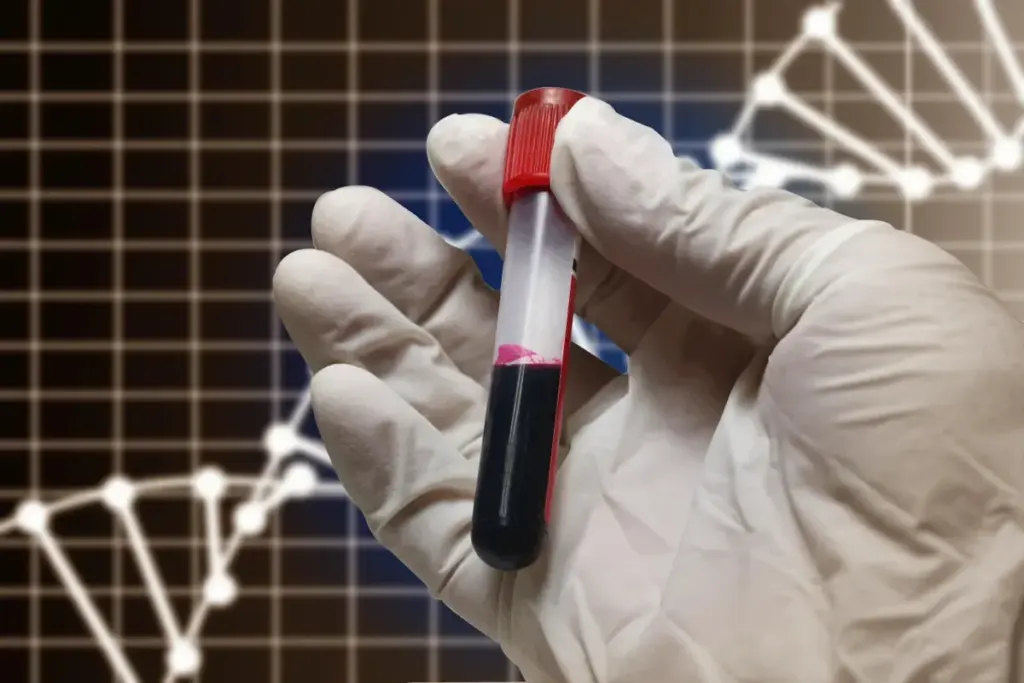 Hemophilia: Diagnosis and Evaluation