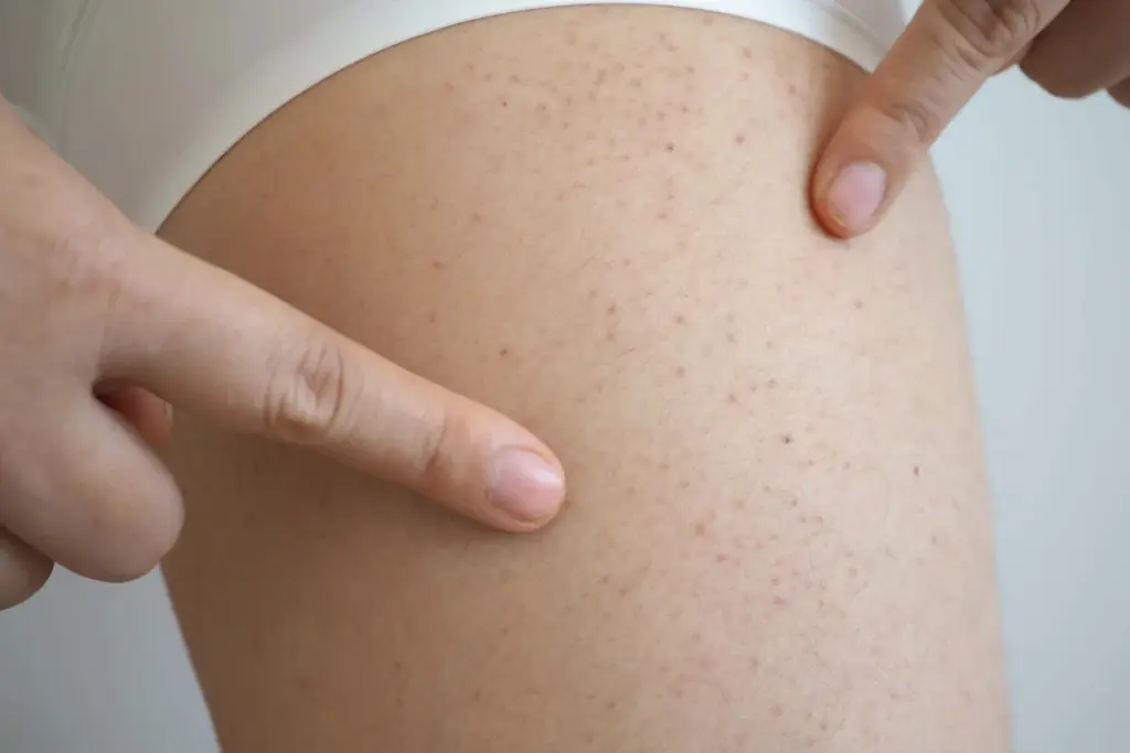 image 6 141 LIV Hospital