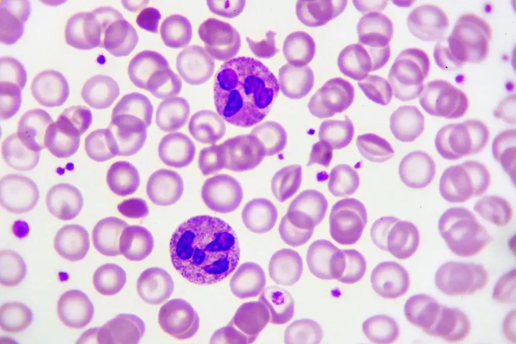 image 11 139 LIV Hospital