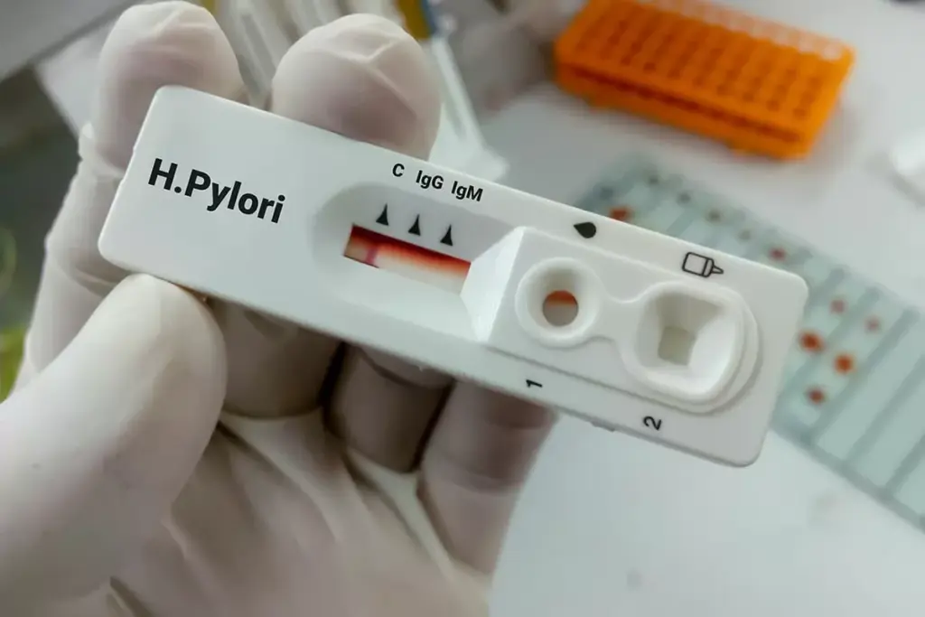 Helicobacter Pylori Testing
