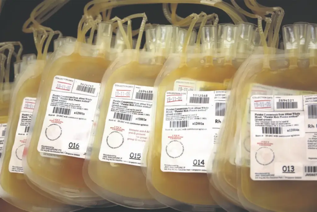 Platelet Transfusion