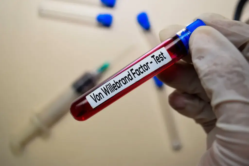 Von Willebrand Disease: Overview and Definition