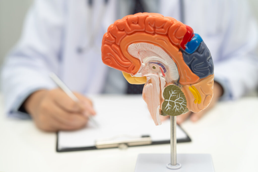 asian doctor with brain anatomy model treatment hospital LIV Hospital