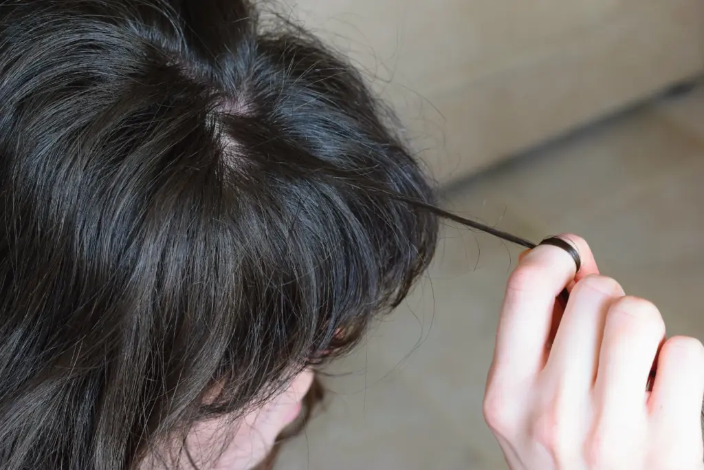 trichotillomania-hair-pulling