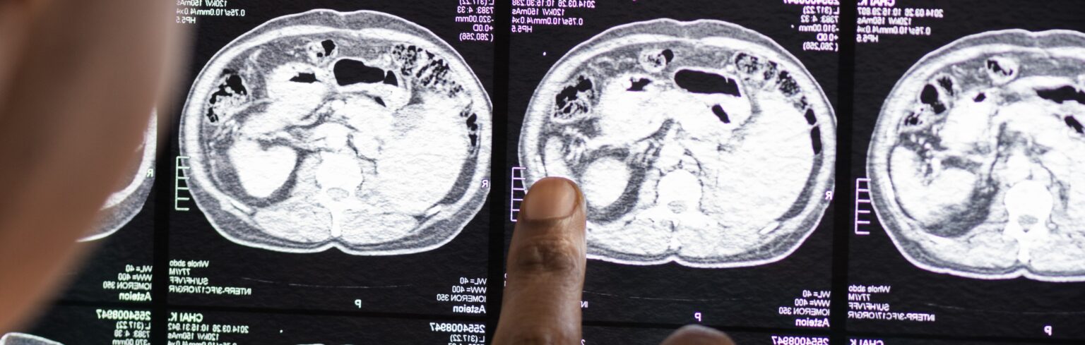 doctor reading brain mri x ray result 6 LIV Hospital