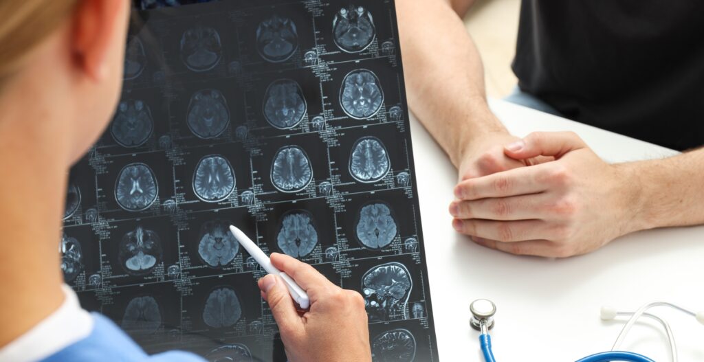 young female doctor is looking mri image human head 9 LIV Hospital