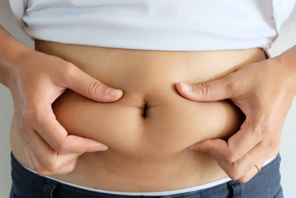 Umbilicoplasty Techniques