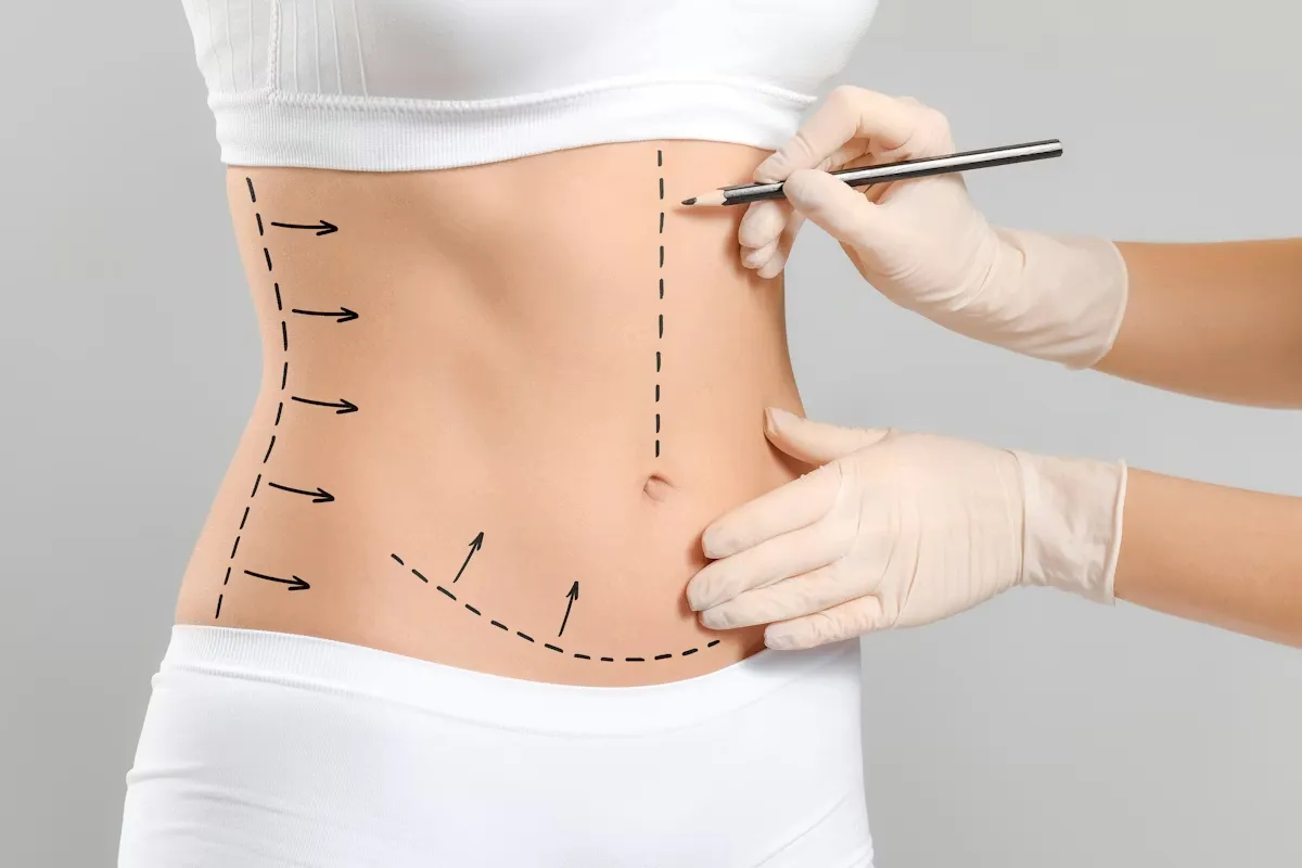 High Lateral Tension Technique