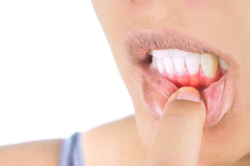 image 8 237 LIV Hospital