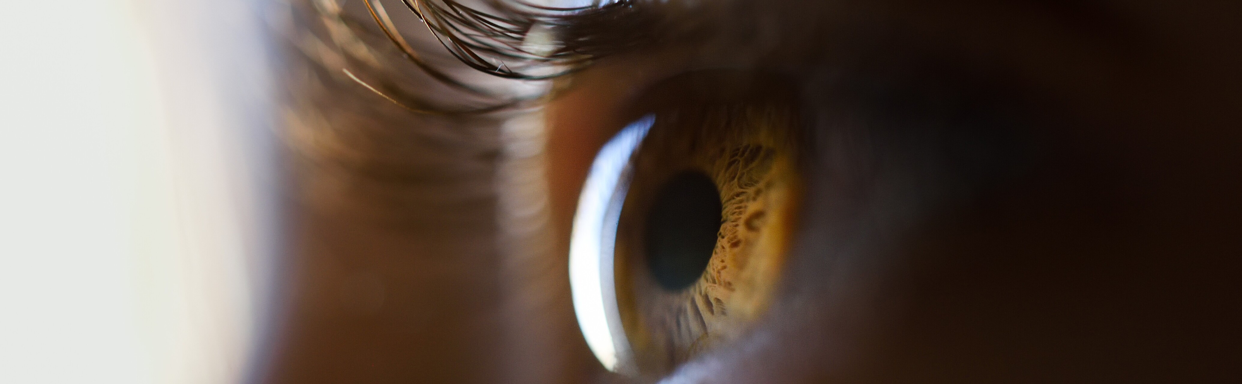 close up beautiful little girl brown eye 1 1 LIV Hospital