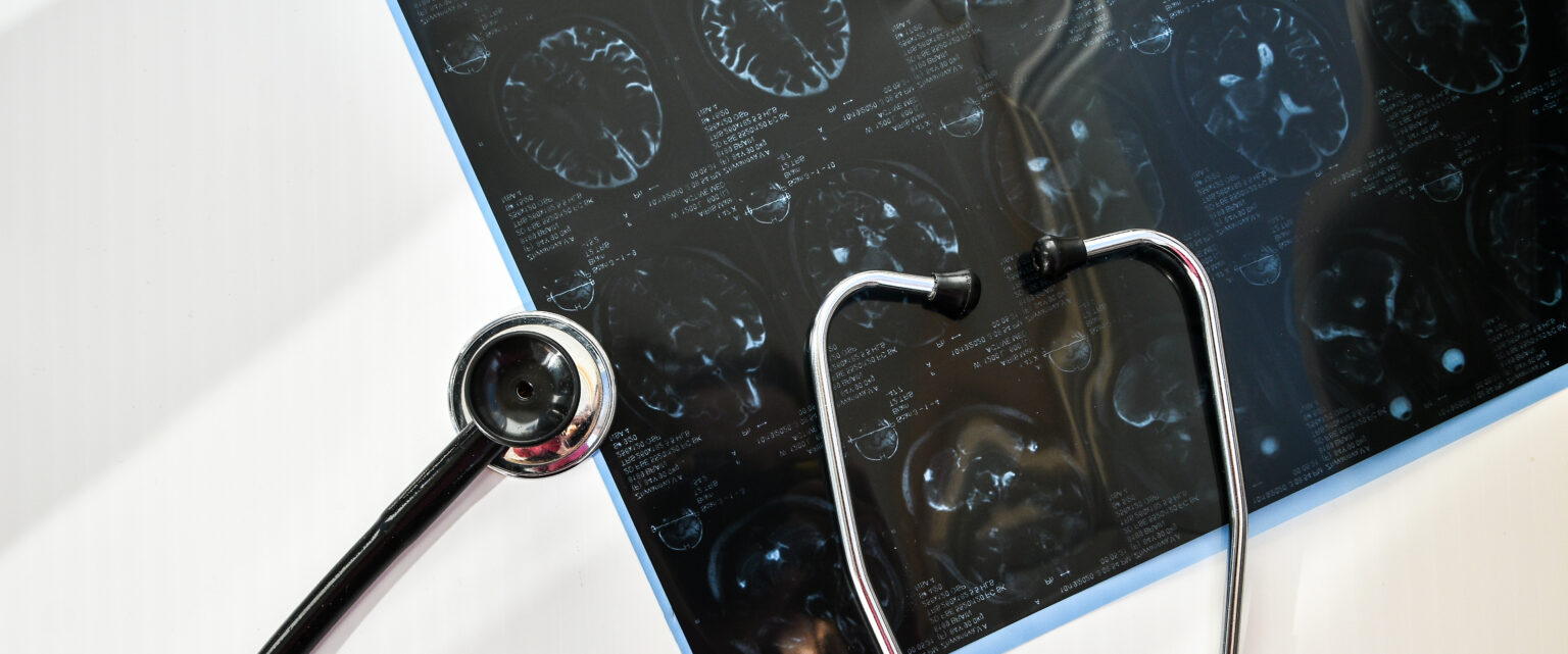 mri medical office mri scan human head clinic with stethoscope top view doctor s desk table 1 LIV Hospital