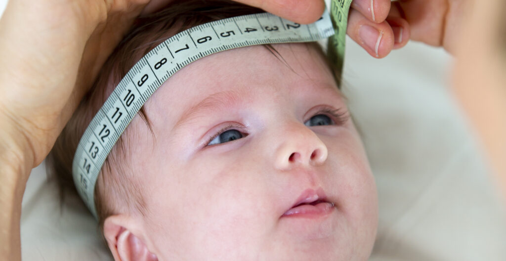 Congenital hydrocephalus