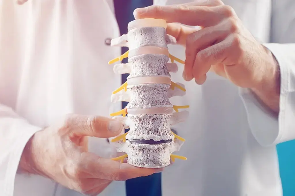 What Is a Cadaver Bone Graft and How Does It Work in Spinal Fusion?