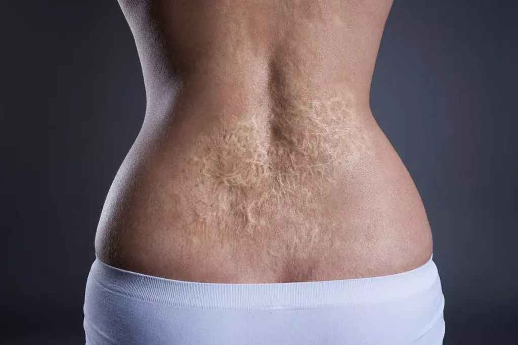 Do Stitches Leave Scars? What You Need to Know 2 Do Stitches Leave Scars? What You Need to Know