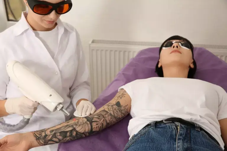 How Bad Does Tattoo Removal Really Hurt?