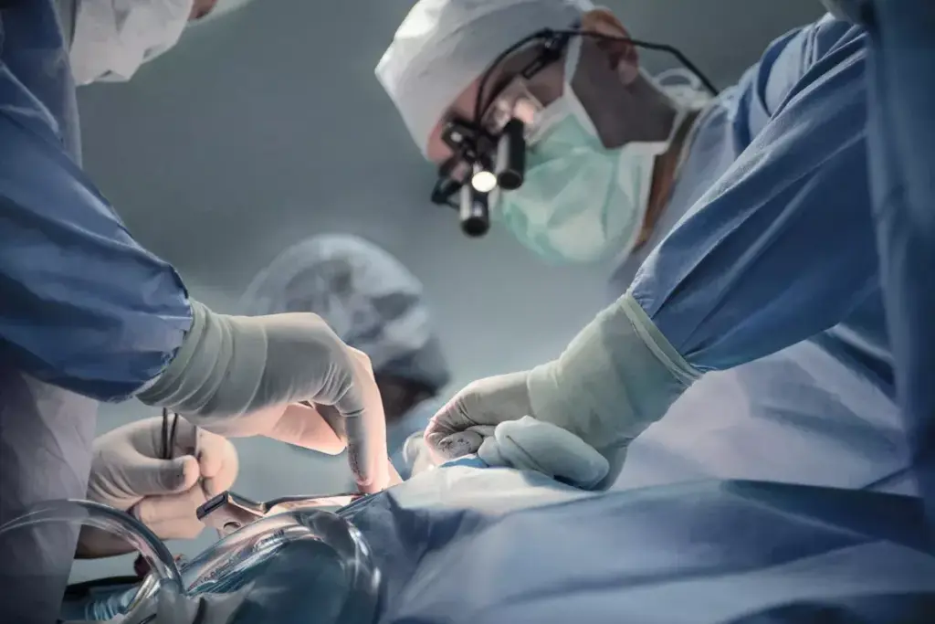 How to Prepare for Flap Surgery: A Complete Guide