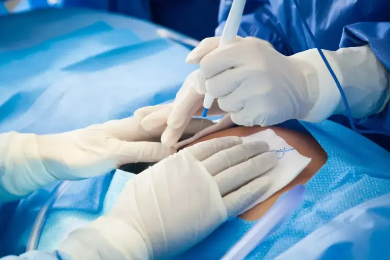 How to Tell If Your Surgical Wound Is Infected
