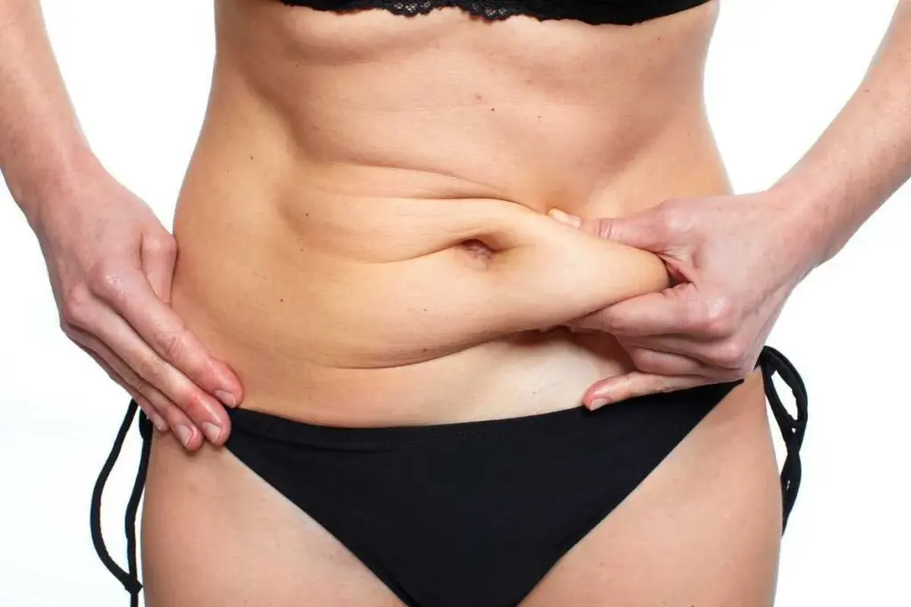 How to Get BBL Results Without a Tummy Tuck