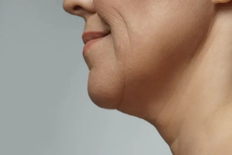How to Tighten Sagging Jowls Without Surgery