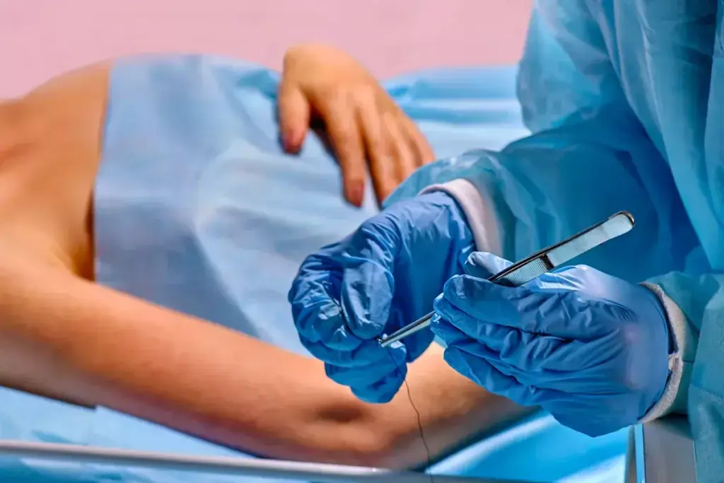 Anchor vs Lollipop Breast Reduction: Which Incision Is Right for You? 1 image 2847 LIV Hospital