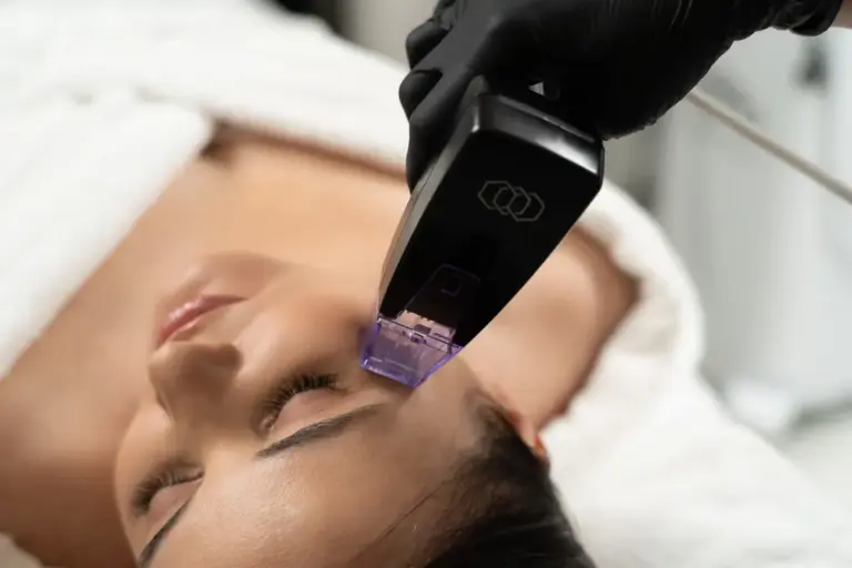 How to Tighten Jawline Skin with RF Microneedling