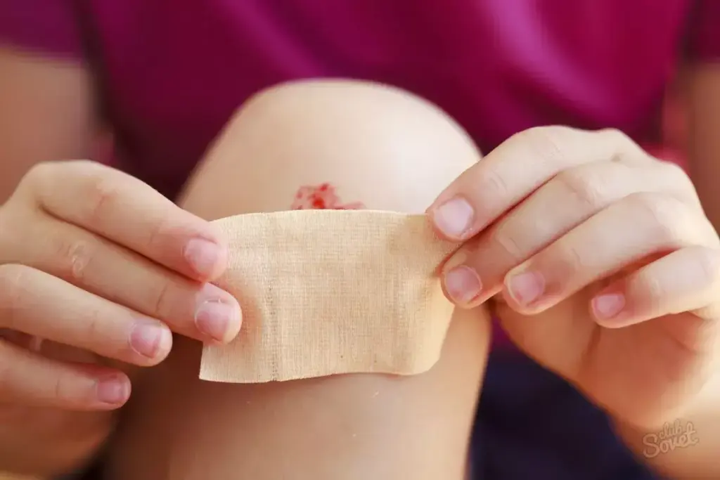 How to Treat Graze Wounds: Stop Bleeding and Pain 2 How to Treat Graze Wounds: Stop Bleeding and Pain
