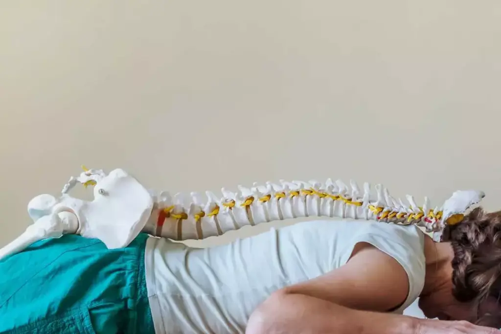 What Is a Cadaver Bone Graft and How Does It Work in Spinal Fusion?