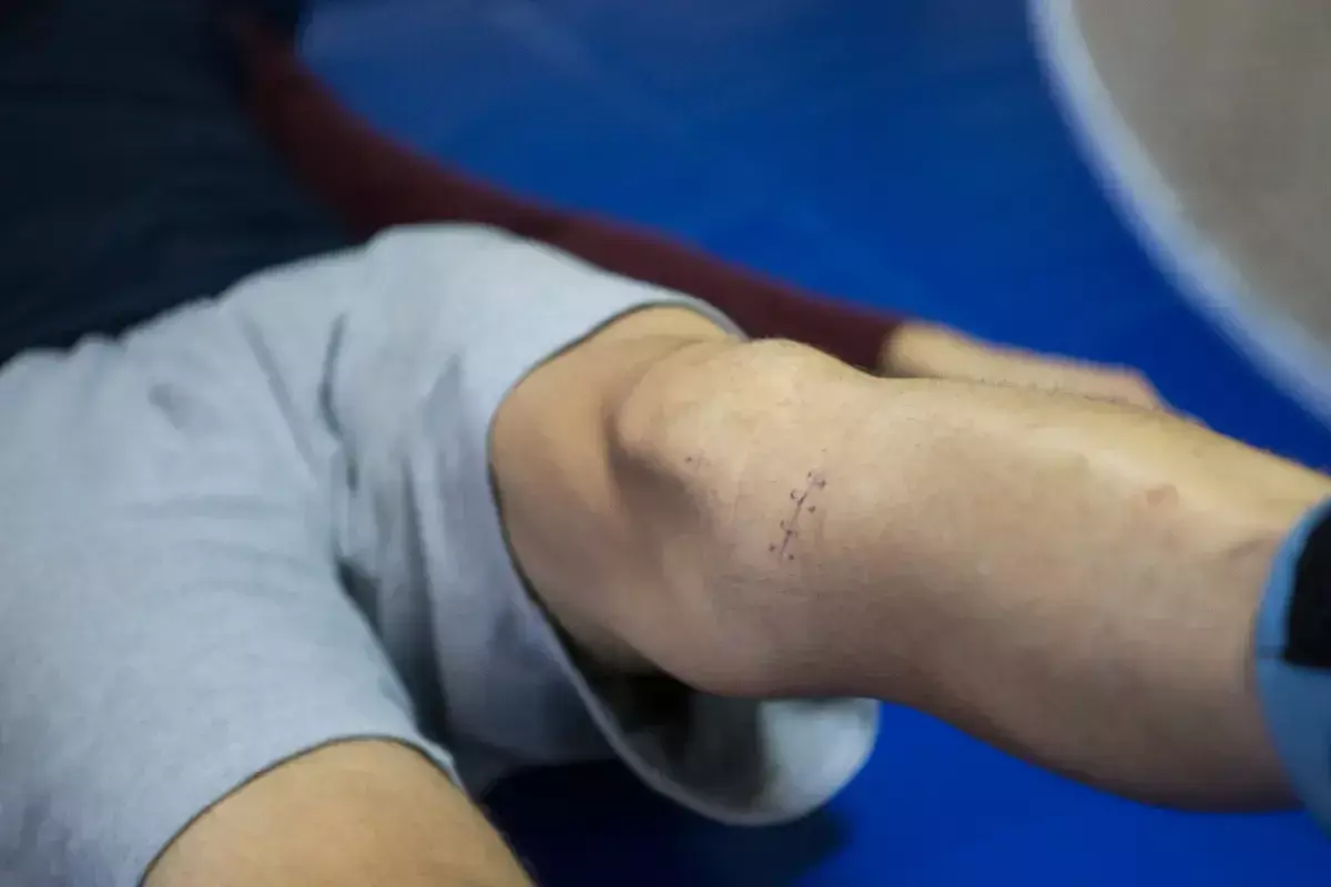 How to Treat Injury Skin: Quick Recovery Guide