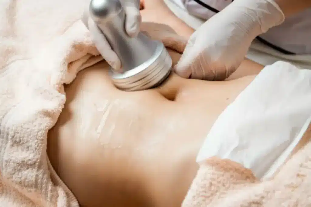 Laser Lipo vs Ultrasonic Cavitation: Which Works Better?