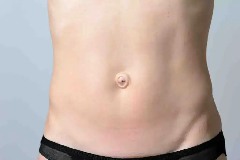 Can You Get Your Belly Button Removed? What You Need to Know 1 Can You Get Your Belly Button Removed? What You Need to Know