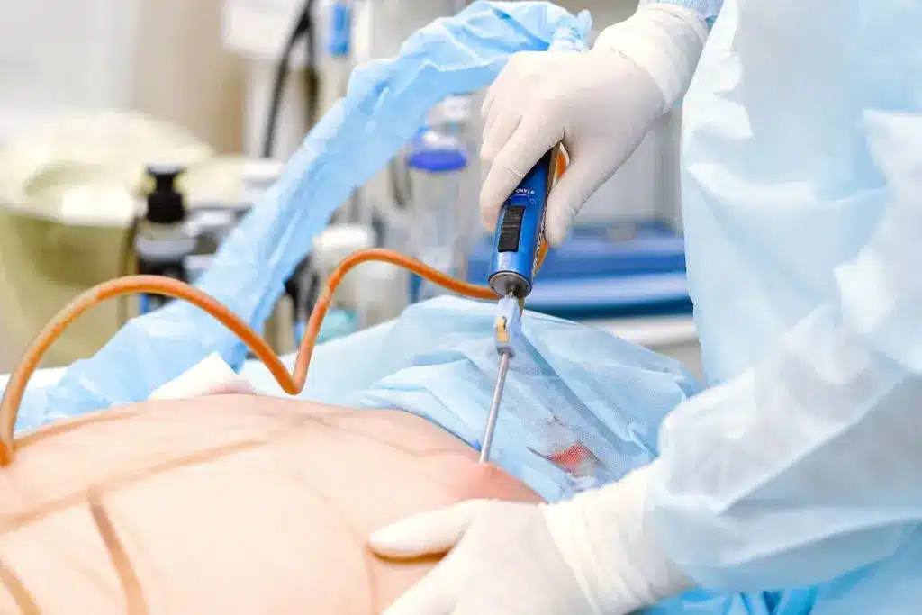 Is SmartLipo Safe? Everything You Need to Know 1 Is SmartLipo Safe? Everything You Need to Know