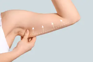 How to Get an Arm Lift: Complete Plastic Surgery Guide