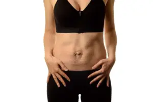 How to Fix Abdominal Bulge: Diastasis Recti vs Hernia