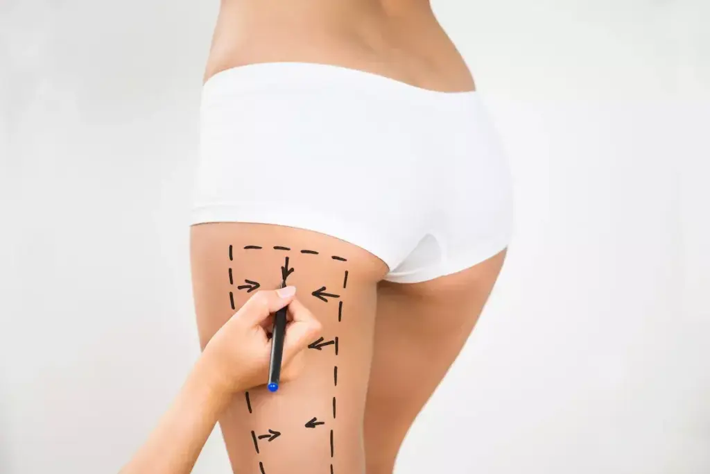 How to Sit After Thigh Lift Surgery: Recovery Guide