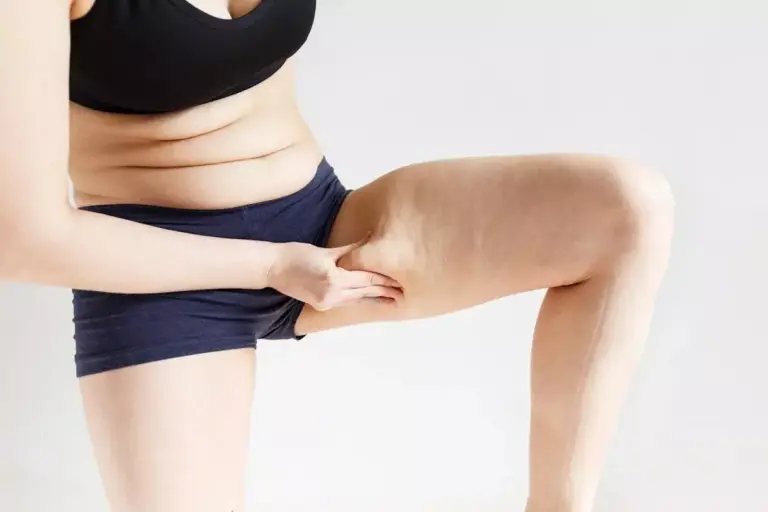How to Eliminate Leg Fat: Complete Guide