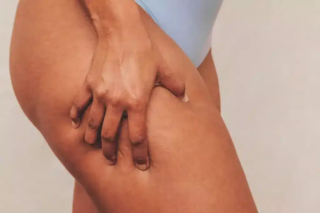 How to Tighten Inner Thigh Skin: 7 Effective Methods