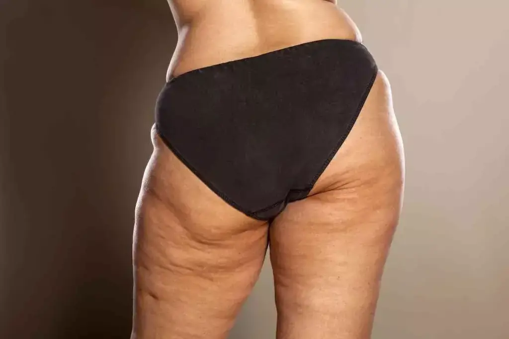 How to Tighten Saggy Thighs: 7 Proven Methods 2 How to Tighten Saggy Thighs: 7 Proven Methods