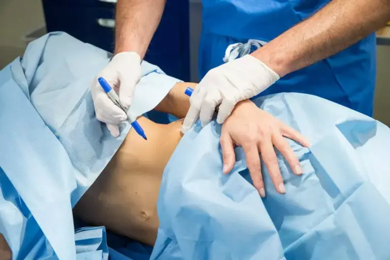 How to Recover from Lipo 360: Timeline & Aftercare