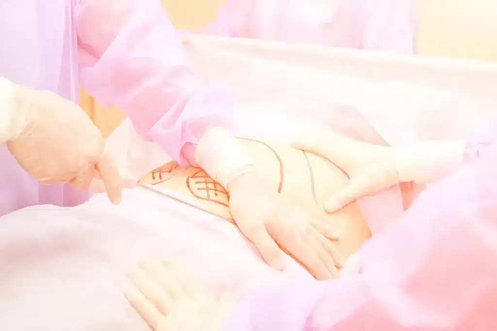 Is Fat Transfer Surgery Good for You? Benefits and Risks Explained 2 Is Fat Transfer Surgery Good for You? Benefits and Risks Explained