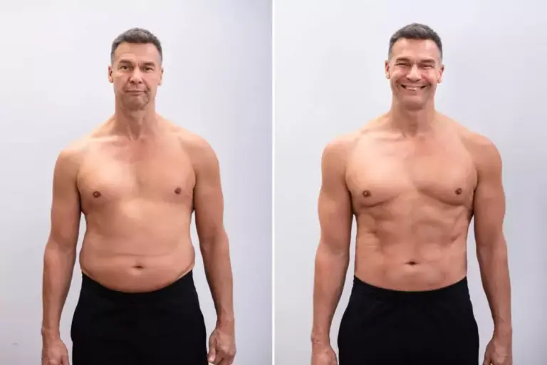 How to Get Fat Transfer Results Without Surgery