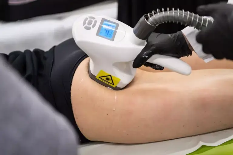 How to Remove Fat with Micro Laser Liposuction