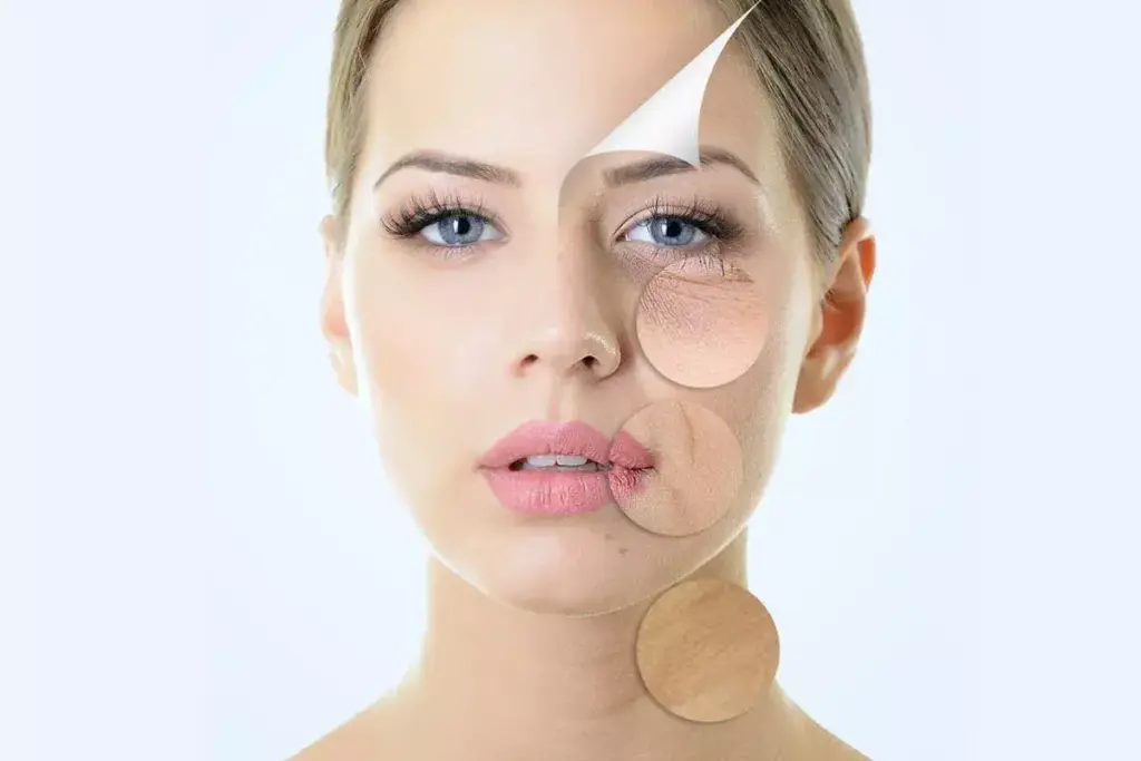 How to Tighten Forehead Skin: Best Treatments