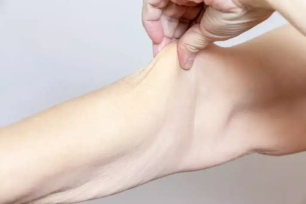 How to Fix Crepey Skin on Legs: Complete Guide 3 How to Fix Crepey Skin on Legs: Complete Guide