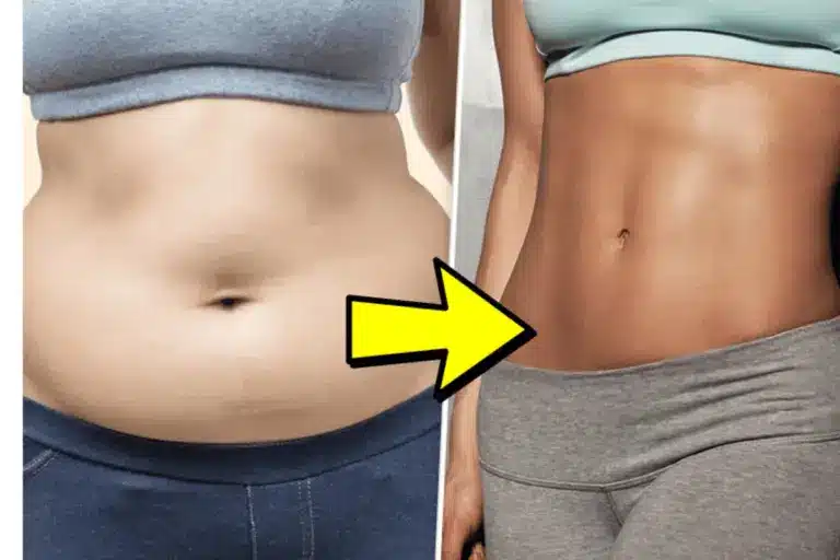 How to Reduce Lower Ab Fat With Liposuction