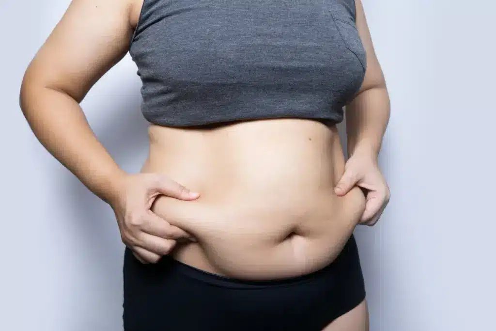 Can Kybella Be Used on Your Stomach and Belly Fat?
